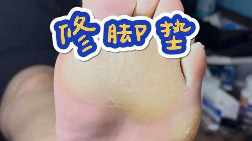 脚解压视频,跟随脚部按摩视频释放身心疲劳